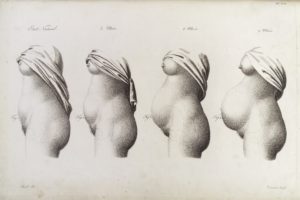 L0038225 Stages in pregnancy as represented by the growth of the womb Credit: Wellcome Library, London. Wellcome Images images@wellcome.ac.uk http://wellcomeimages.org Stages in pregnancy as represented by the growth of the womb from normal state through to 3, 6 and 9 months. (Side view) 19th Century Nouvelles démonstrations d'accouchemens. Avec des planches en taille-donee, accompagnées d'un texte raisonné, propre à en faciliter l'explication Jacques-Pierre Maygrier Published: 1822 Copyrighted work available under Creative Commons Attribution only licence CC BY 4.0 http://creativecommons.org/licenses/by/4.0/